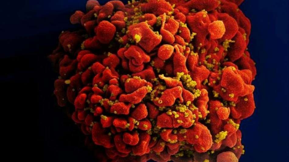 R&uuml;ckschlag bei Suche nach Impfstoff gegen HIV/Aids