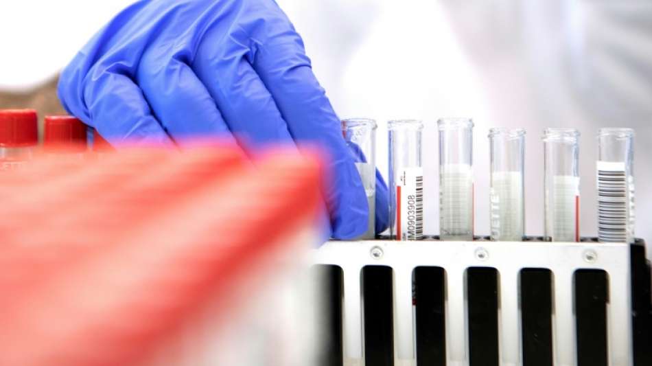 Kein Anspruch mehr auf PCR-Test durch rote Warnmeldung auf Corona-App