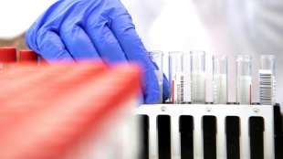 Kein Anspruch mehr auf PCR-Test durch rote Warnmeldung auf Corona-App