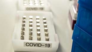 Studie: Vermehrung des Coronavirus l&auml;sst sich mit Crispr-Methode stoppen