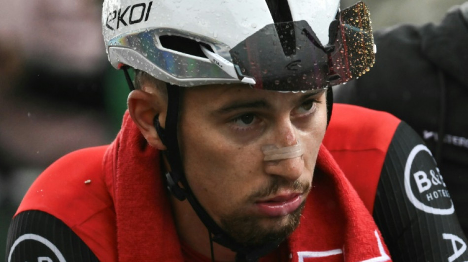 Cyclisme: Vauquelin blessé au niveau de la cheville en descendant un escalier