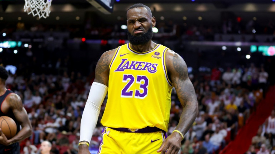 Calf injury sidelines Lakers' James
