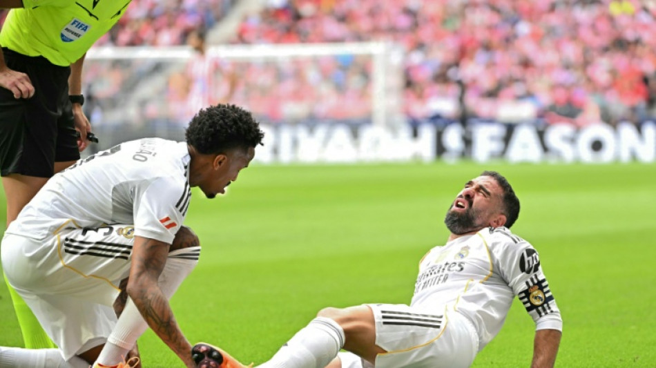 Real Madrid's Carvajal Clasico doubt after calf injury